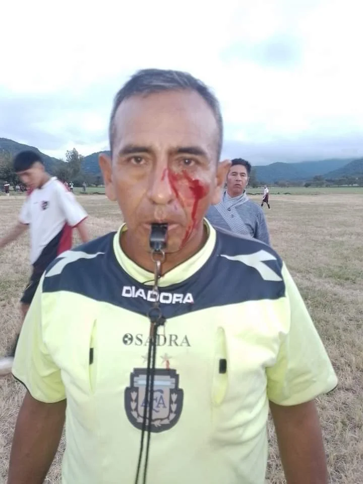 chicoana-arbitro