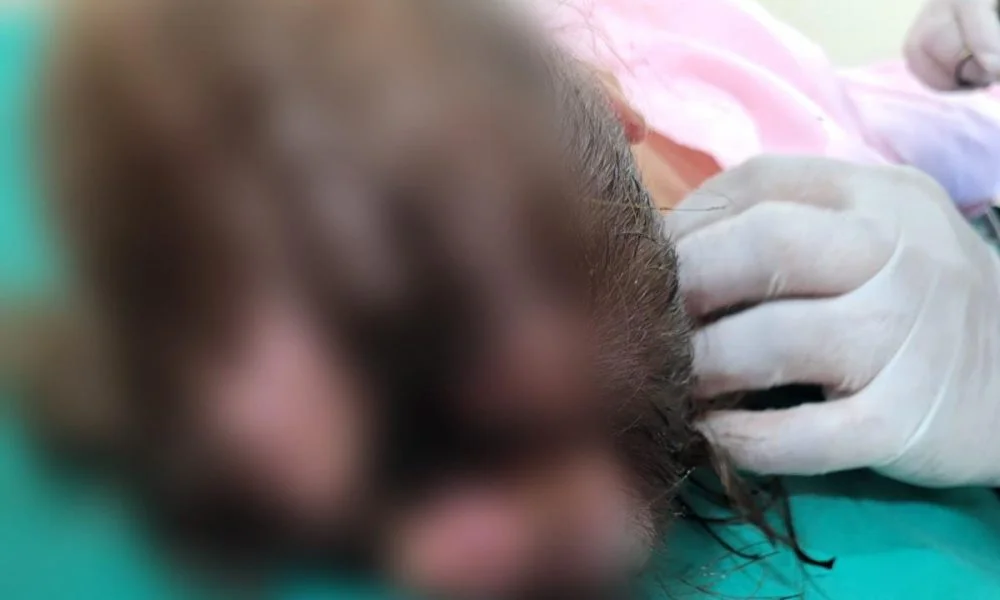 niña-internada-pediculosis