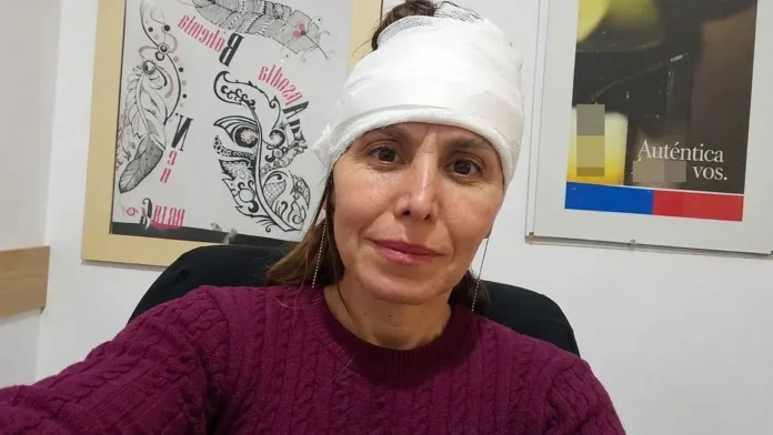 Carolina protegió a su hija con un abrazo antes de que una rama grande cayera sobre ellas.